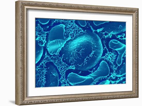 Red Blood Cells, SEM-Science Photo Library-Framed Photographic Print