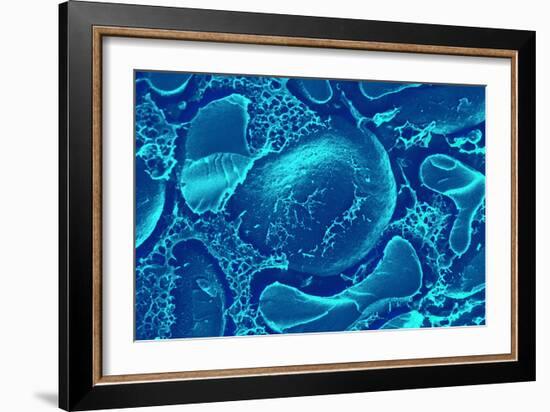 Red Blood Cells, SEM-Science Photo Library-Framed Photographic Print