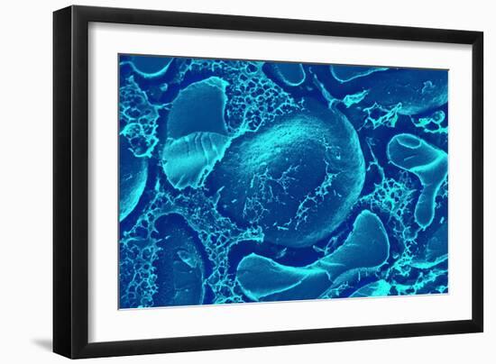 Red Blood Cells, SEM-Science Photo Library-Framed Photographic Print