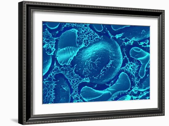 Red Blood Cells, SEM-Science Photo Library-Framed Photographic Print