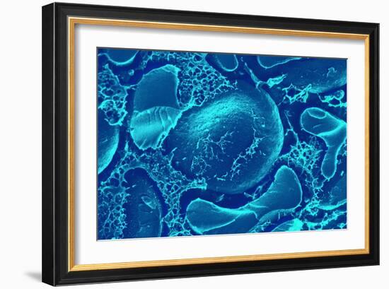 Red Blood Cells, SEM-Science Photo Library-Framed Photographic Print