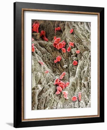 Red Blood Cells, SEM-Science Photo Library-Framed Photographic Print