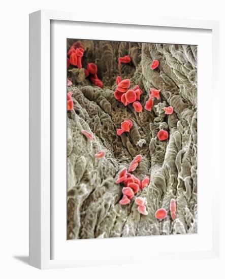 Red Blood Cells, SEM-Science Photo Library-Framed Photographic Print