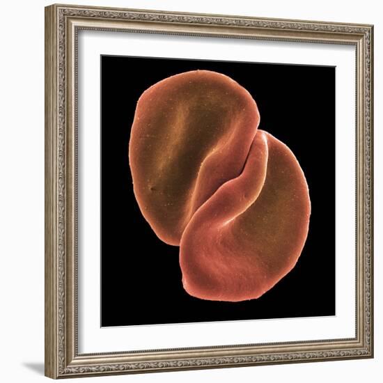 Red Blood Cells-Steve Gschmeissner-Framed Premium Photographic Print