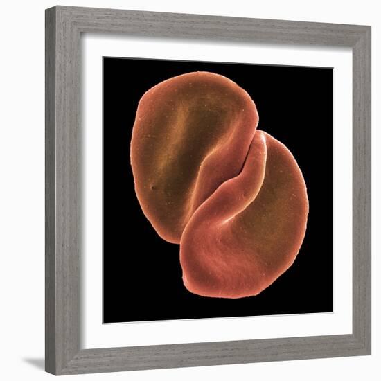 Red Blood Cells-Steve Gschmeissner-Framed Premium Photographic Print