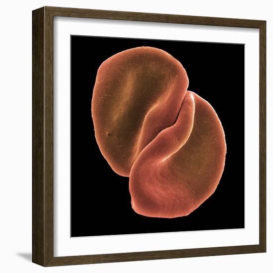 Red Blood Cells-Steve Gschmeissner-Framed Premium Photographic Print