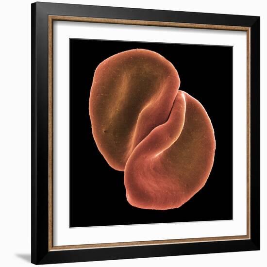 Red Blood Cells-Steve Gschmeissner-Framed Premium Photographic Print