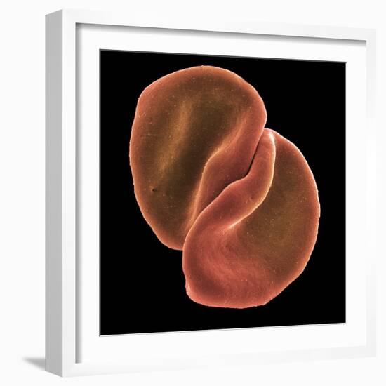 Red Blood Cells-Steve Gschmeissner-Framed Premium Photographic Print