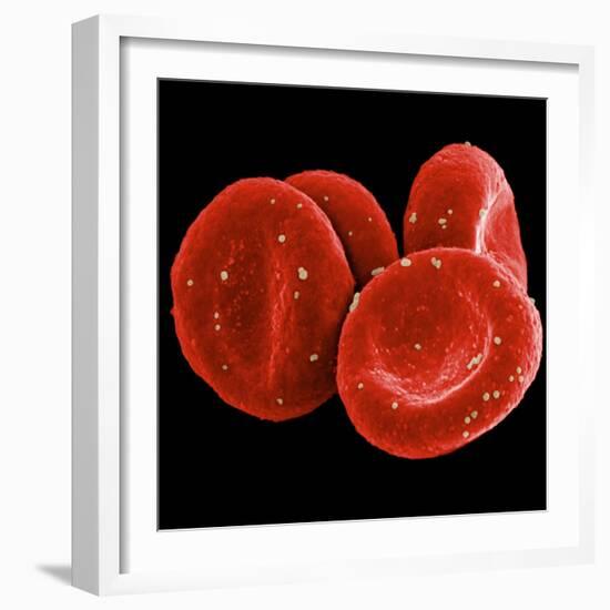 Red Blood Cells-null-Framed Photographic Print