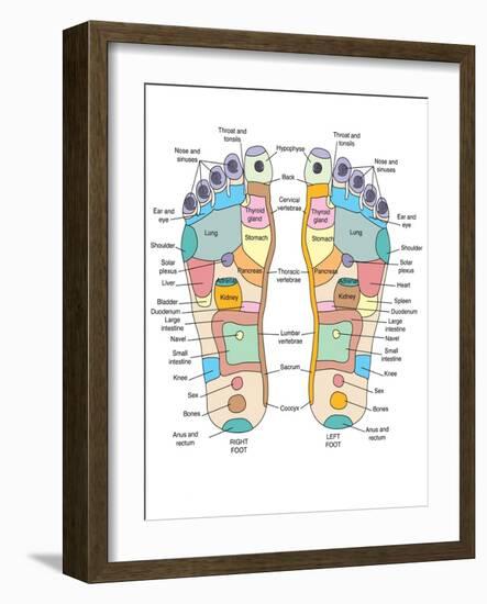 Reflexology Foot Map, Artwork-Peter Gardiner-Framed Photographic Print