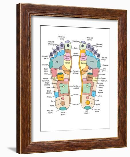 Reflexology Foot Map, Artwork-Peter Gardiner-Framed Photographic Print