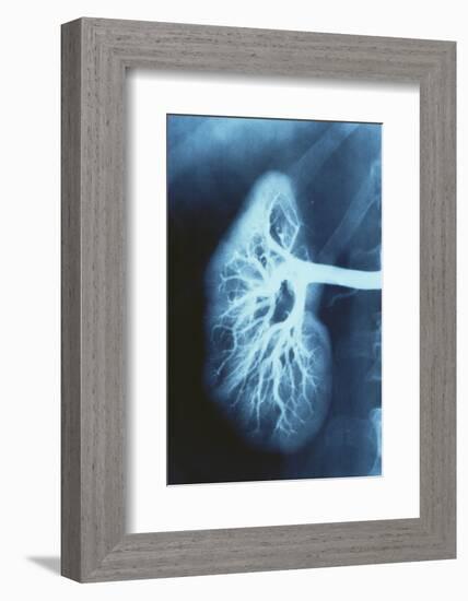 Renal Blood Vessels, X-ray-null-Framed Photographic Print