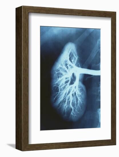 Renal Blood Vessels, X-ray-null-Framed Photographic Print