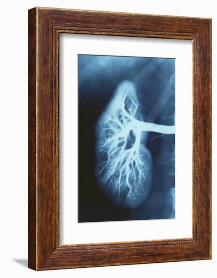 Renal Blood Vessels, X-ray-null-Framed Photographic Print