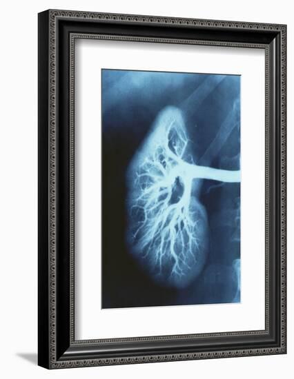 Renal Blood Vessels, X-ray-null-Framed Photographic Print