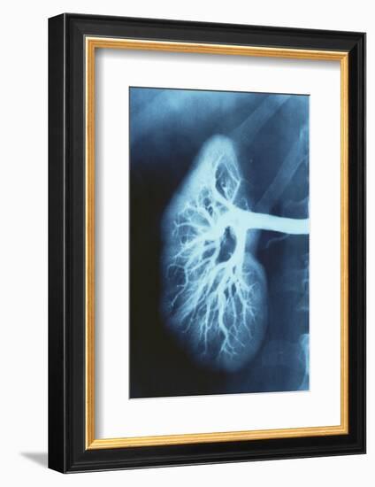 Renal Blood Vessels, X-ray-null-Framed Photographic Print