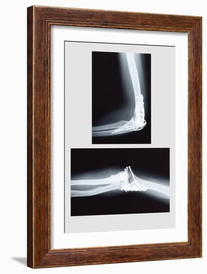 Repaired Elbow-null-Framed Premium Giclee Print