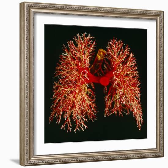 Resin Cast of Pulmonary Arteries And Bronchi-Martin Dohrn-Framed Premium Photographic Print