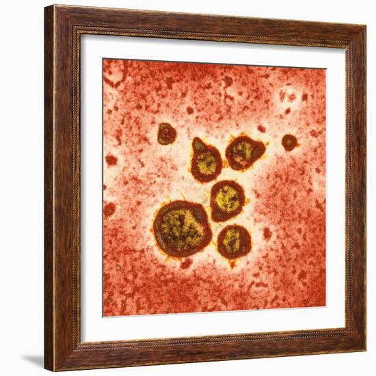 Respiratory Syncytial Virus, TEM-Hazel Appleton-Framed Premium Photographic Print