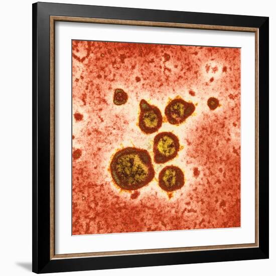 Respiratory Syncytial Virus, TEM-Hazel Appleton-Framed Premium Photographic Print