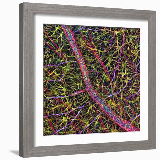 Retina Blood Vessel And Nerve Cells-Thomas Deerinck-Framed Premium Photographic Print