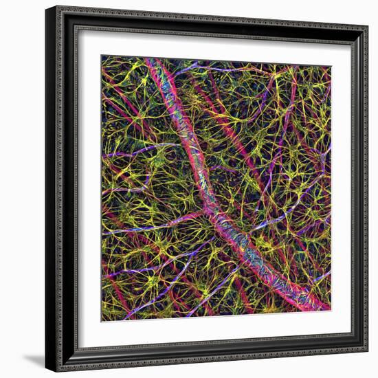 Retina Blood Vessel And Nerve Cells-Thomas Deerinck-Framed Premium Photographic Print