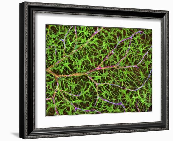 Retina Blood Vessel And Nerve Cells-Thomas Deerinck-Framed Photographic Print