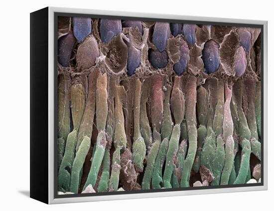 Retina Rod Cells, SEM-Science Photo Library-Framed Premier Image Canvas