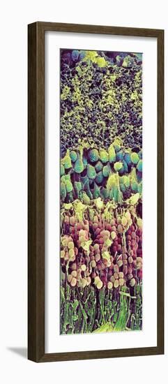 Retina-Steve Gschmeissner-Framed Photographic Print