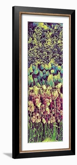 Retina-Steve Gschmeissner-Framed Photographic Print