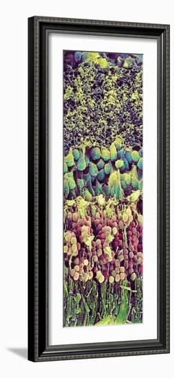 Retina-Steve Gschmeissner-Framed Photographic Print