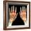 Rheumatoid Arthritis of the Hands, X-ray-Du Cane Medical-Framed Premium Photographic Print