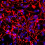 Nerve Cell Trauma Response-Riccardo Cassiani-ingoni-Photographic Print