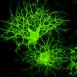 Nerve Cells-Riccardo Cassiani-ingoni-Framed Photographic Print