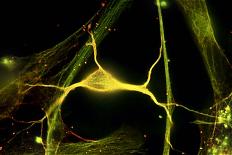 Hippocampal Neuron Fluorescent Micrograph-Robert Mcneil-Photographic Print