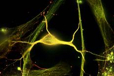 Hippocampal Neuron Fluorescent Micrograph-Robert Mcneil-Framed Premier Image Canvas