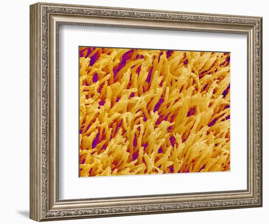 Rod and Cone Layer of Retina of Rabbit-Micro Discovery-Framed Photographic Print