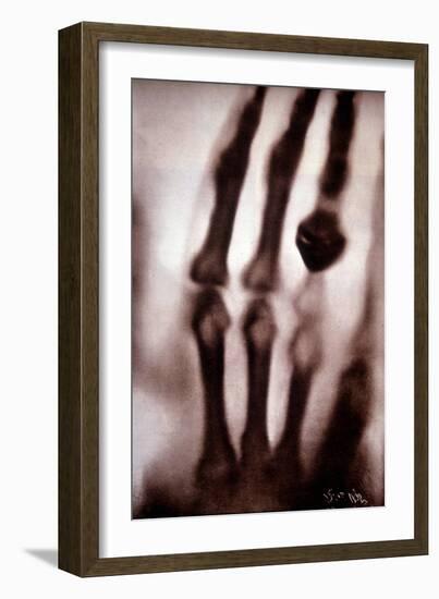 Roentgen Rays (Rontgen) or X-Rays First Photograph: the Hand of Roentgen's Wife. 22/12/1895.-Unknown Artist-Framed Giclee Print