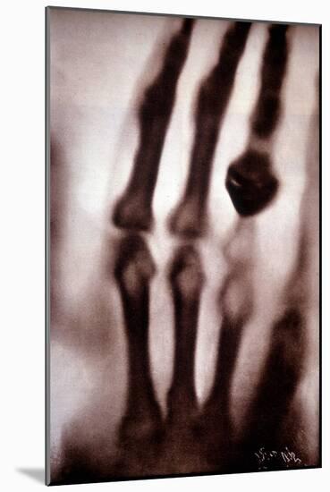 Roentgen Rays (Rontgen) or X-Rays First Photograph: the Hand of Roentgen's Wife. 22/12/1895.-Unknown Artist-Mounted Giclee Print