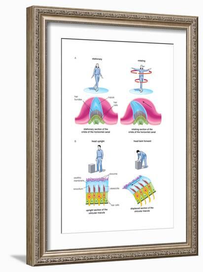 Root Canal Therapy. Dentistry, Endodontics, Teeth, Tooth Damage, Oral Health, Health and Disease-Encyclopaedia Britannica-Framed Art Print