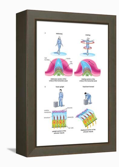 Root Canal Therapy. Dentistry, Endodontics, Teeth, Tooth Damage, Oral Health, Health and Disease-Encyclopaedia Britannica-Framed Stretched Canvas