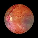 Normal Retina of Eye-Rory McClenaghan-Photographic Print