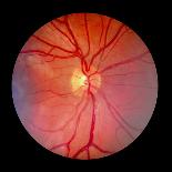 Normal Retina of Eye-Rory McClenaghan-Photographic Print