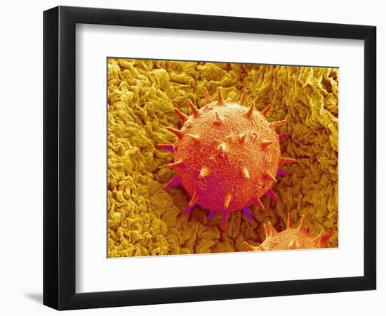 Rose of Sharon Pollen-Micro Discovery-Framed Photographic Print