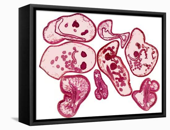 Roundworms, Light Micrograph-Steve Gschmeissner-Framed Premier Image Canvas