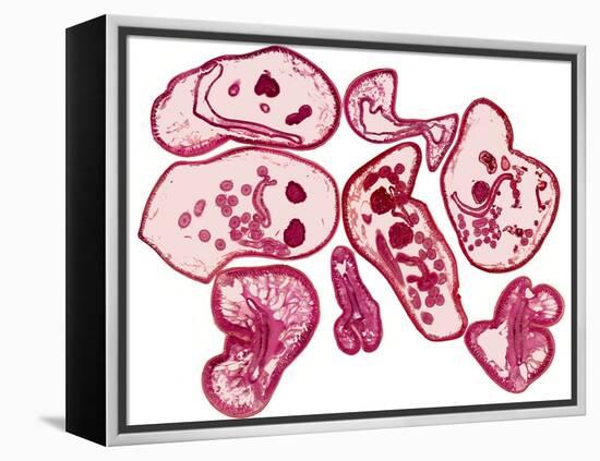 Roundworms, Light Micrograph-Steve Gschmeissner-Framed Premier Image Canvas