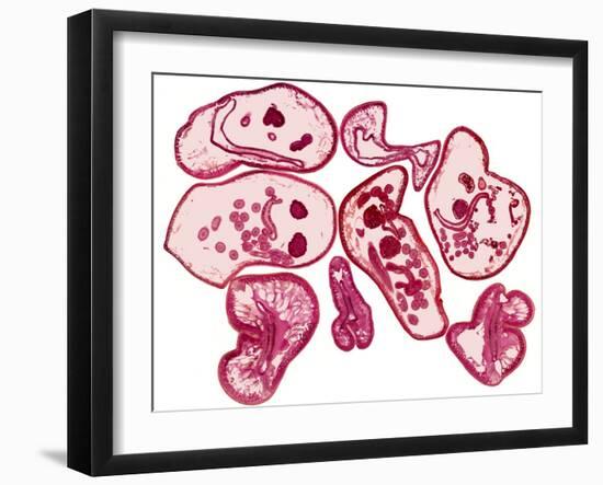 Roundworms, Light Micrograph-Steve Gschmeissner-Framed Photographic Print
