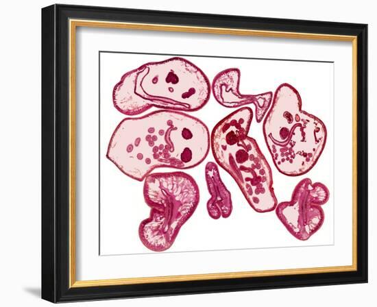 Roundworms, Light Micrograph-Steve Gschmeissner-Framed Photographic Print