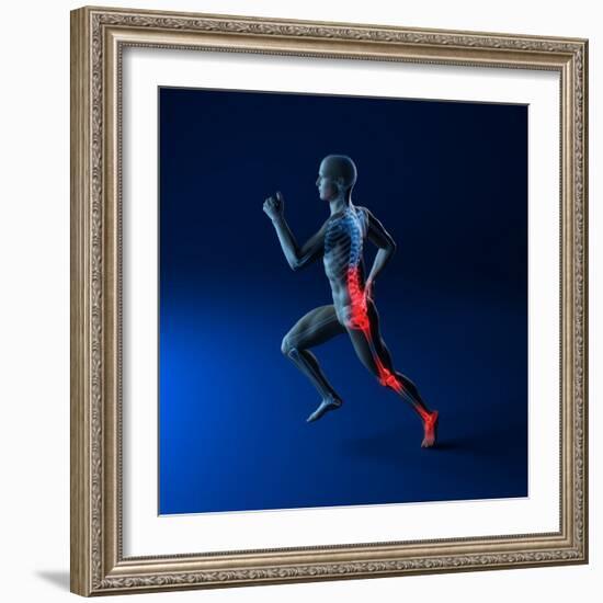 Running Injuries, Conceptual Artwork-SCIEPRO-Framed Premium Photographic Print