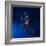 Running Injuries, Conceptual Artwork-SCIEPRO-Framed Premium Photographic Print